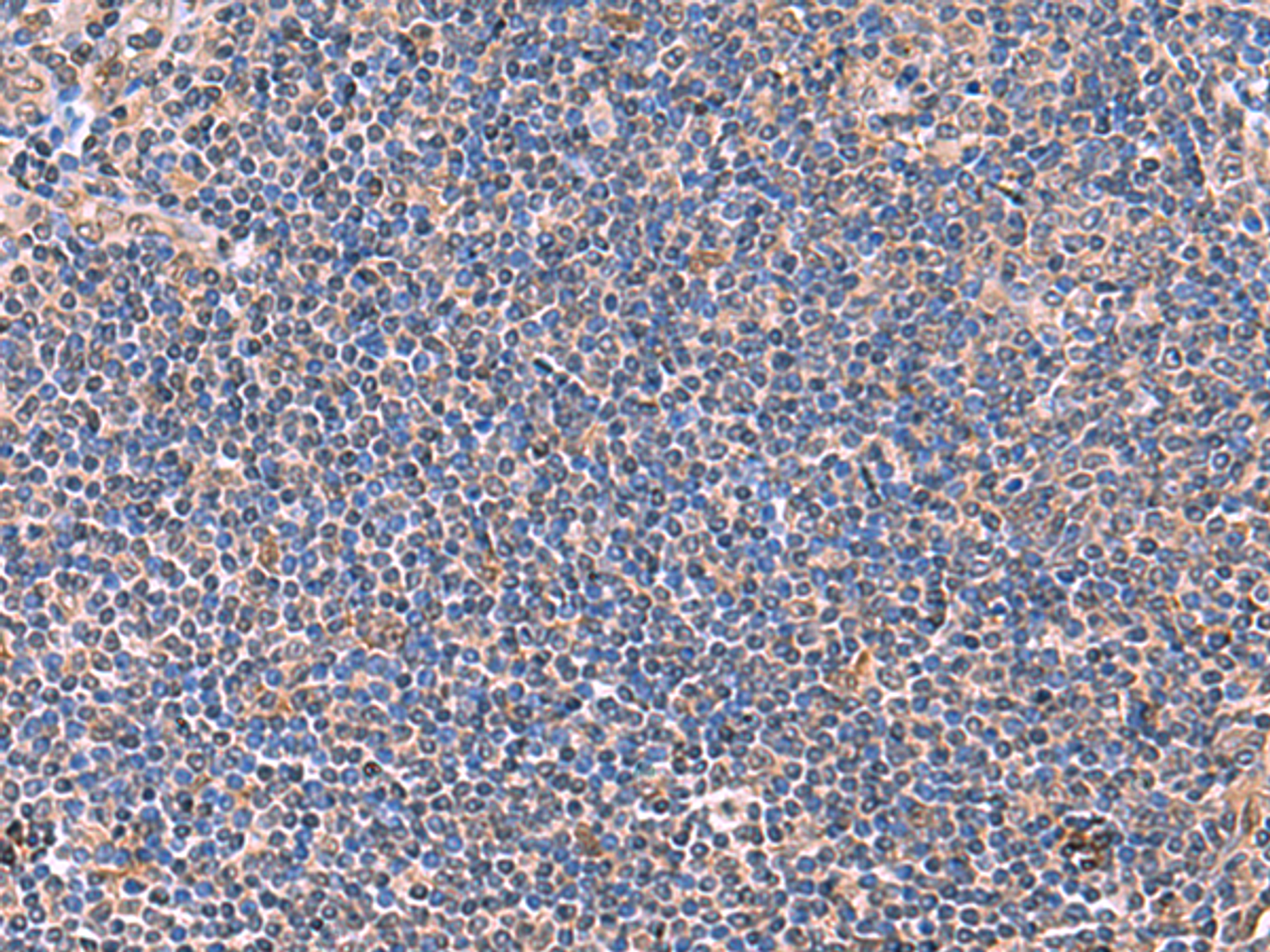 Immunohistochemistry of paraffin-embedded Human tonsil tissue  using PEPD Polyclonal Antibody at dilution of 1:70(×200)