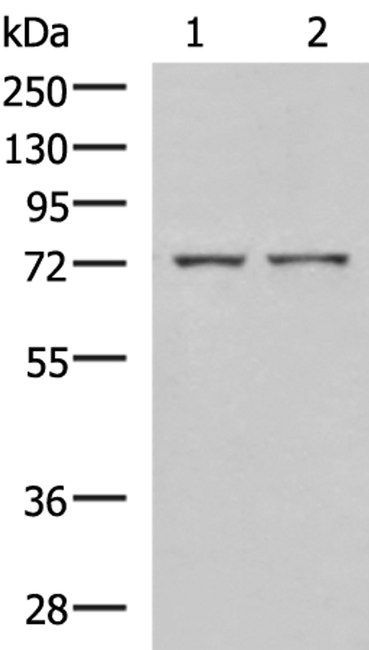 Western blot analysis of Mouse liver tissue and Jurkat cell lysates  using ZAP70 Polyclonal Antibody at dilution of 1:800