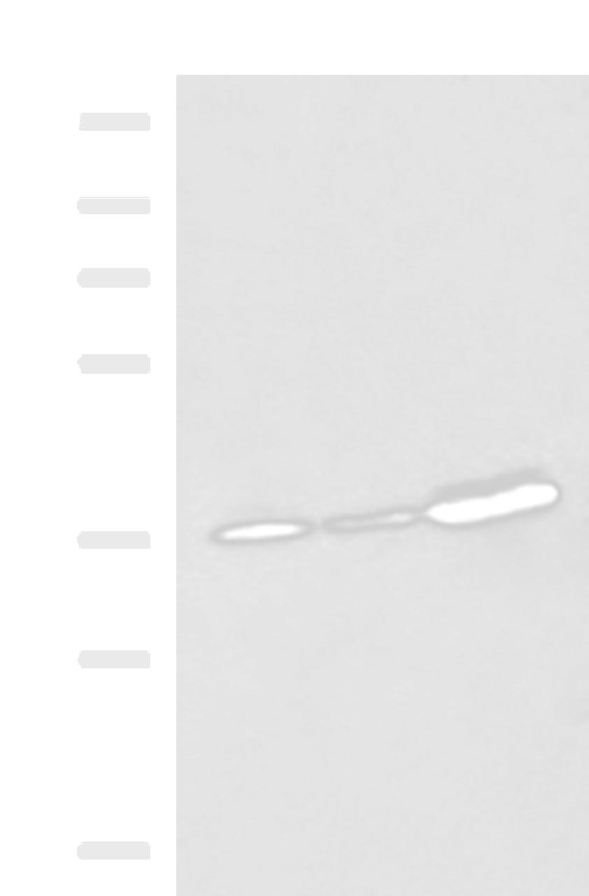 Western blot analysis of A549 A172 and HepG2 cell lysates  using EEF1D Polyclonal Antibody at dilution of 1:950