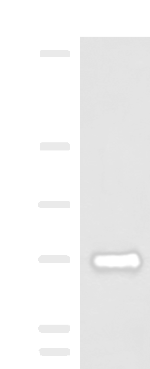 Western blot analysis of Human fetal brain tissue lysate  using PPEF1 Polyclonal Antibody at dilution of 1:1500