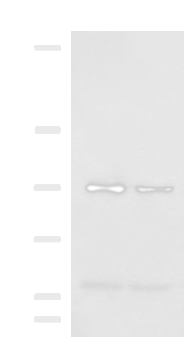 Western blot analysis of 293T and Jurkat cell lysates  using NVL Polyclonal Antibody at dilution of 1:1000