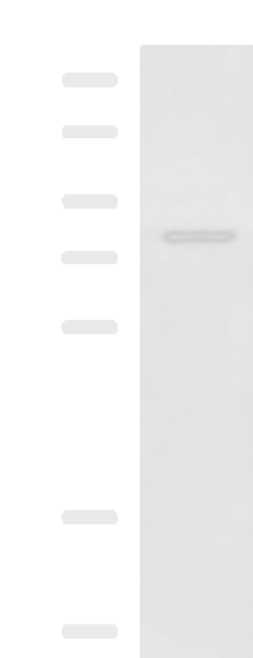 Western blot analysis of Rat liver tissue lysate  using DHX58 Polyclonal Antibody at dilution of 1:800