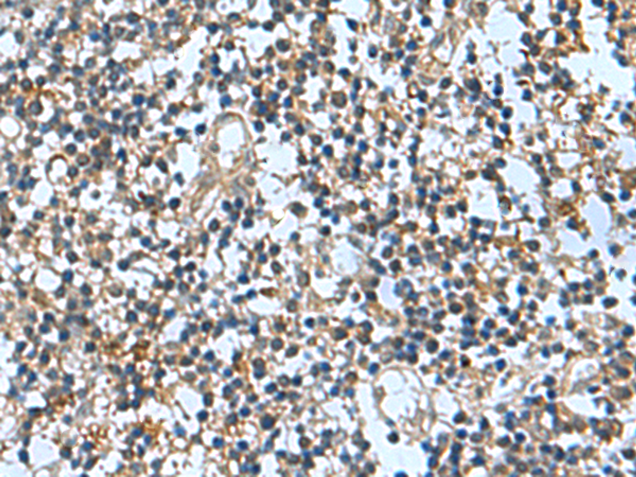Immunohistochemistry of paraffin-embedded Human tonsil tissue  using TRO Polyclonal Antibody at dilution of 1:65(×200)