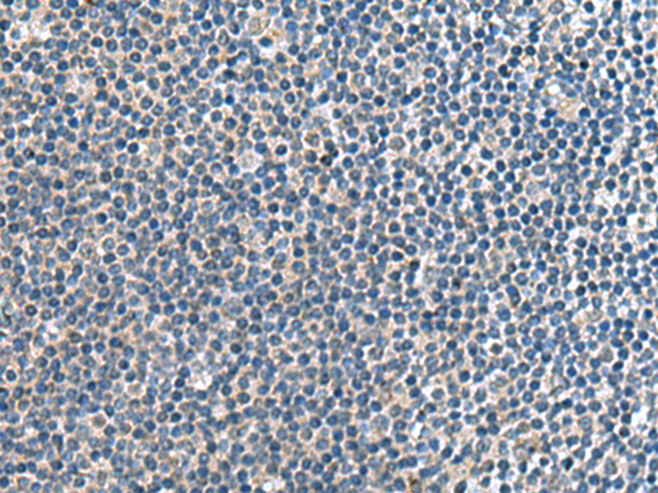 Immunohistochemistry of paraffin-embedded Human tonsil tissue  using CNTN4 Polyclonal Antibody at dilution of 1:65(×200)