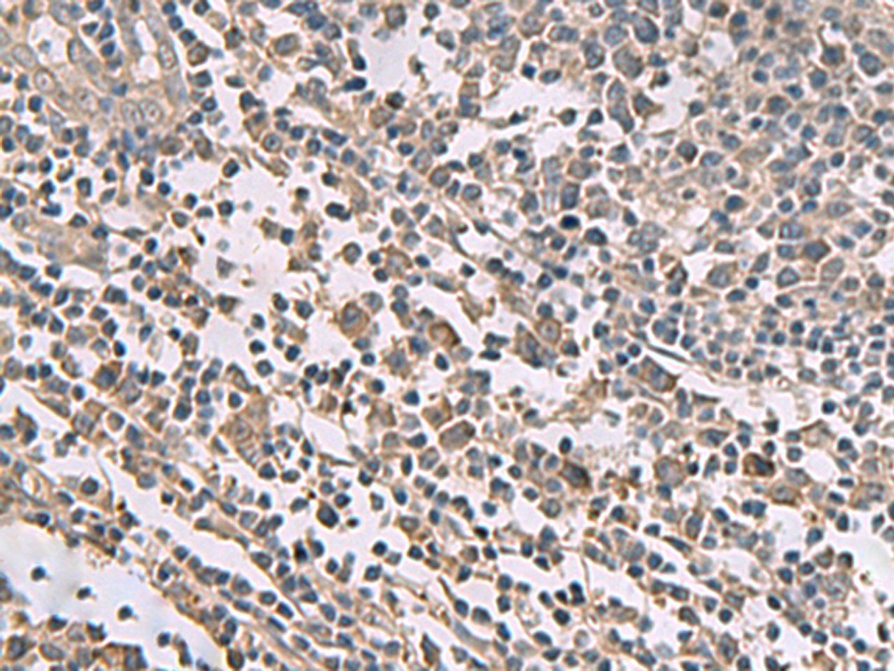 Immunohistochemistry of paraffin-embedded Human tonsil tissue  using TMEM141 Polyclonal Antibody at dilution of 1:60(×200)