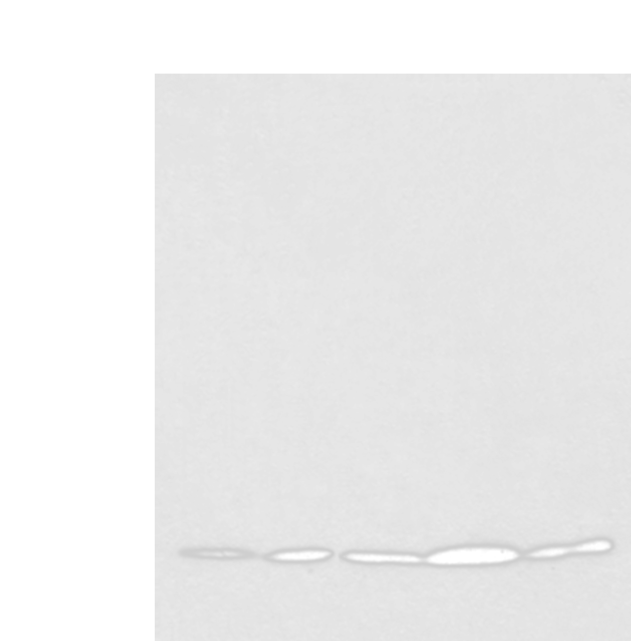 Western blot analysis of HL-60 Hela Jurkat LNCAP HepG2 cell lysates  using PAM16 Polyclonal Antibody at dilution of 1:900