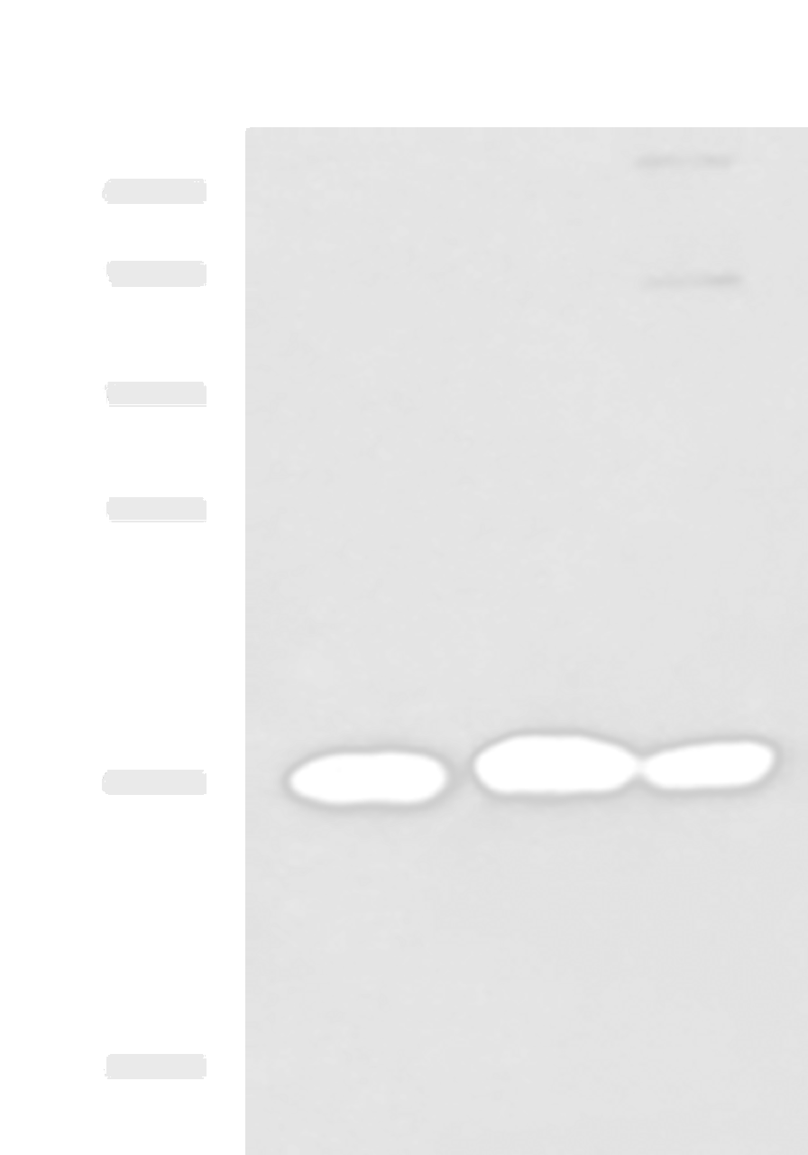 Western blot analysis of 231 HL60 and Jurkat cell lysates  using RPS14 Polyclonal Antibody at dilution of 1:700
