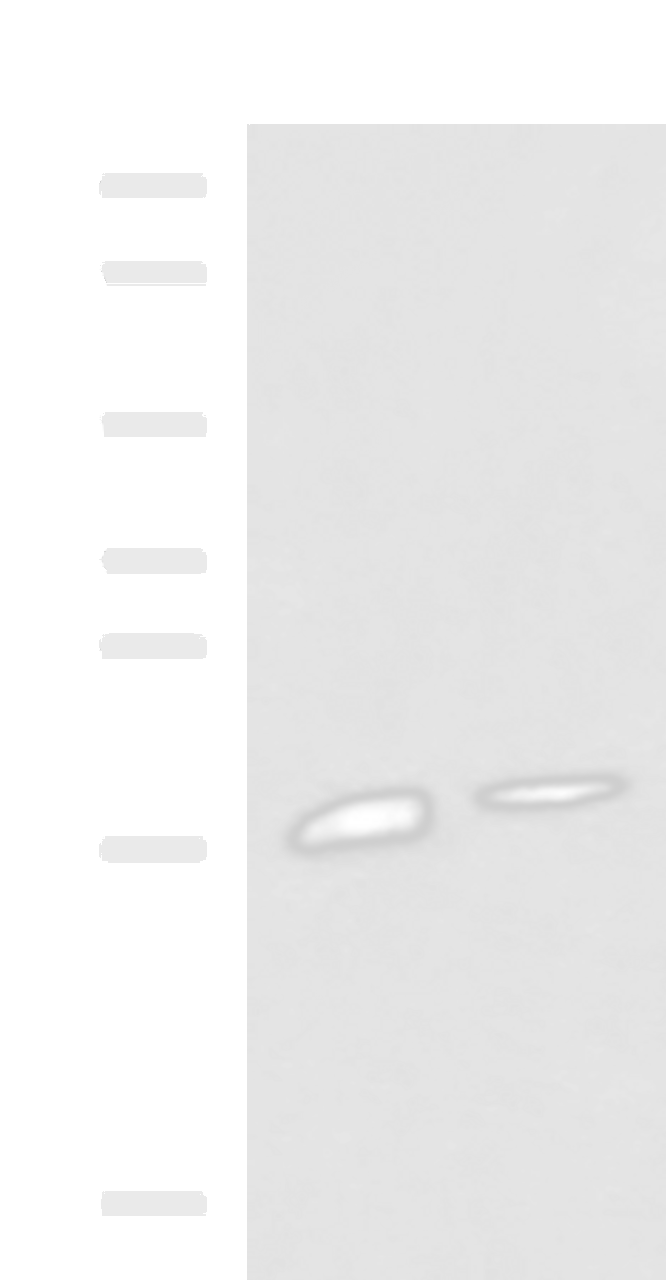 Western blot analysis of Rat pancreas tissue and Mouse pancreas tissue lysates  using RNASE1 Polyclonal Antibody at dilution of 1:650