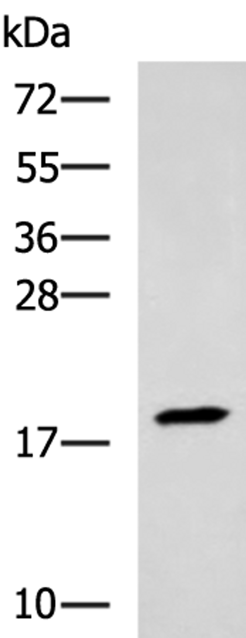 Western blot analysis of Human muscle tissue lysate  using TNNC2 Polyclonal Antibody at dilution of 1:400