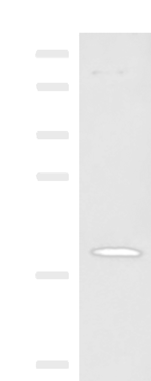 Western blot analysis of Human heart tissue lysate  using DNPH1 Polyclonal Antibody at dilution of 1:800