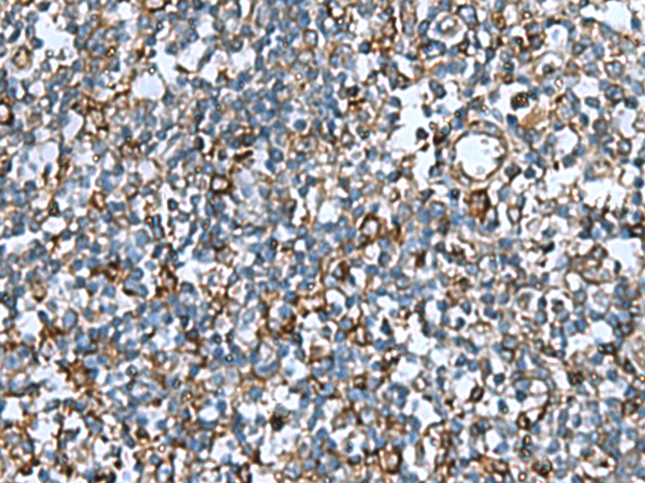 Immunohistochemistry of paraffin-embedded Human tonsil tissue  using COMMD9 Polyclonal Antibody at dilution of 1:60(×200)