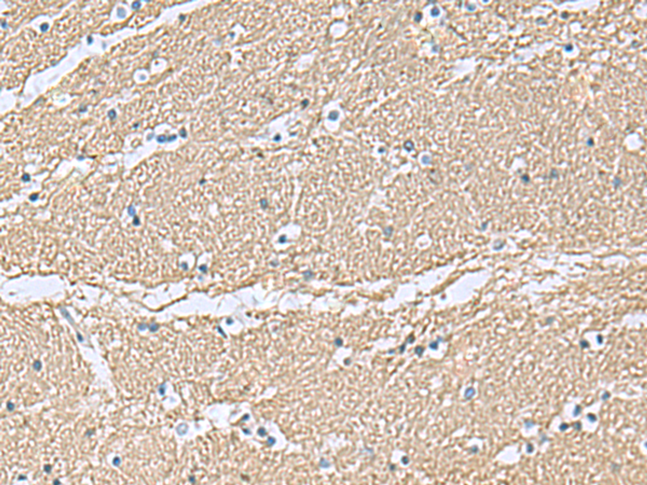 Immunohistochemistry of paraffin-embedded Human brain tissue  using TAGLN3 Polyclonal Antibody at dilution of 1:70(×200)