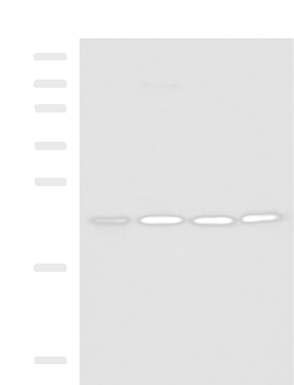 Western blot analysis of K562 A172 Jurkat LOVO cell lysates  using MRPL40 Polyclonal Antibody at dilution of 1:1000