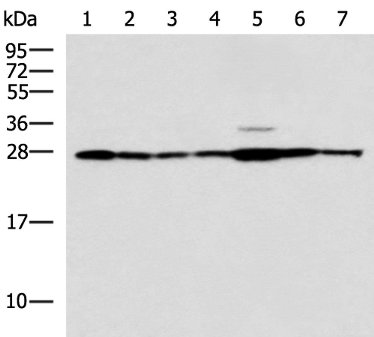 Western blot analysis of Rat liver tissue Mouse kidney tissue Mouse lung tissue HUVEC Jurkat Hela HepG2 cell lysates  using RPL10A Polyclonal Antibody at dilution of 1:700