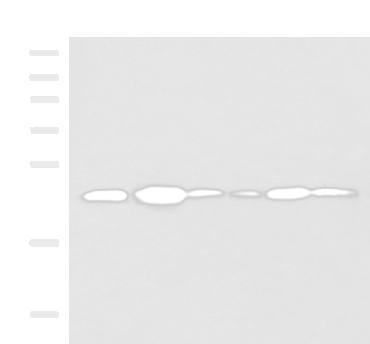 Western blot analysis of NIH/3T3 cell Mouse Pancreas tissue Rat lung tissue Mouse liver tissue Hela Raji cell lysates  using TMED10 Polyclonal Antibody at dilution of 1:900