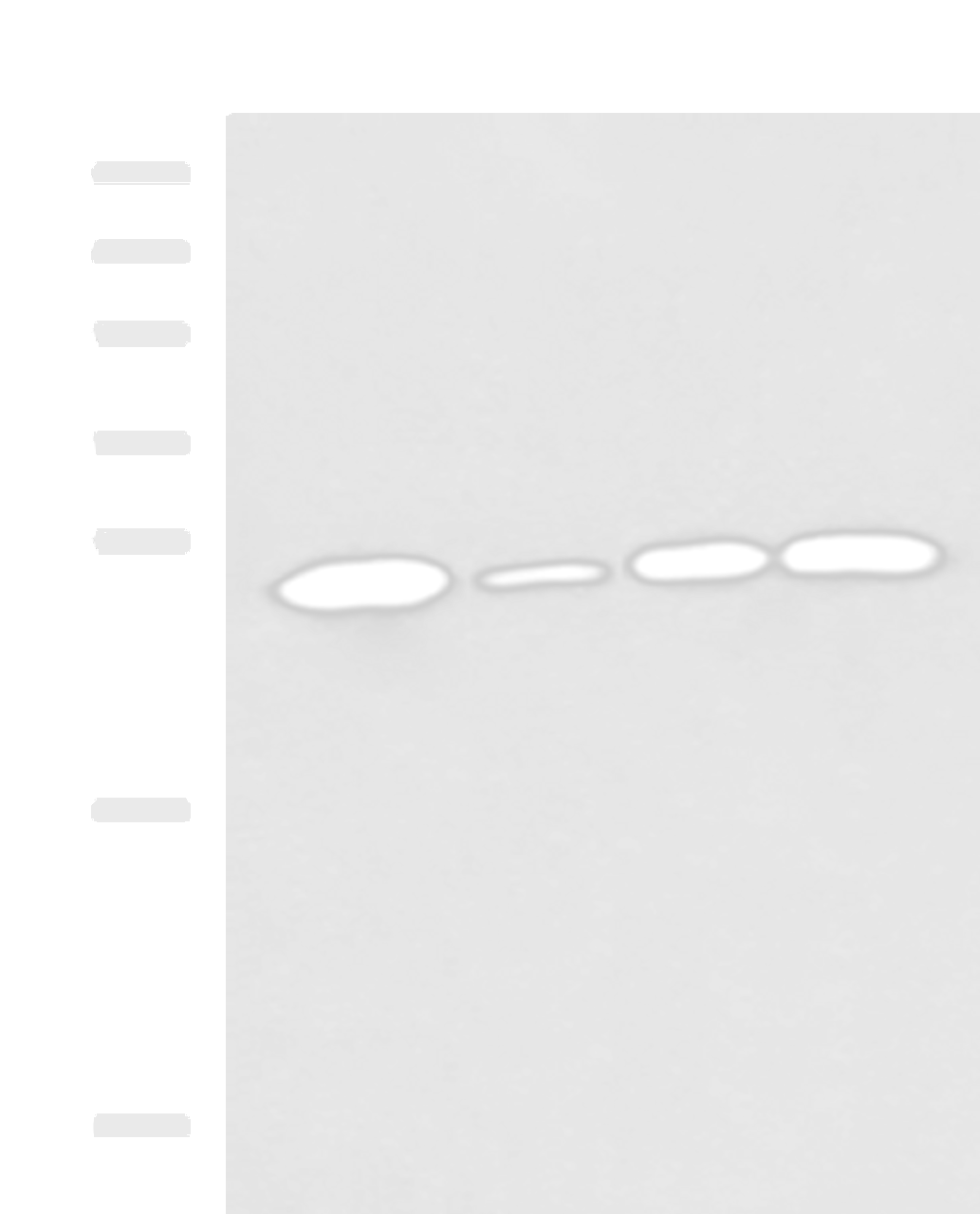 Western blot analysis of Human cerebrum tissue A172 cell Mouse brain tissue Rat brain tissue lysates  using UCHL1 Polyclonal Antibody at dilution of 1:900