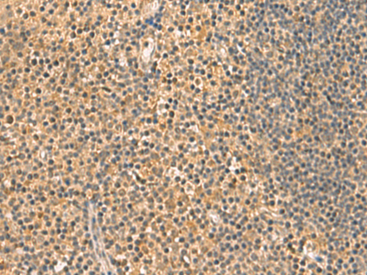 Immunohistochemistry of paraffin-embedded Human tonsil tissue  using UCHL1 Polyclonal Antibody at dilution of 1:60(×200)