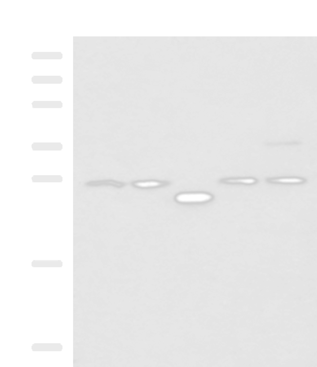 Western blot analysis of 293T cell lysates  using PSMA6 Polyclonal Antibody at dilution of 1:1000