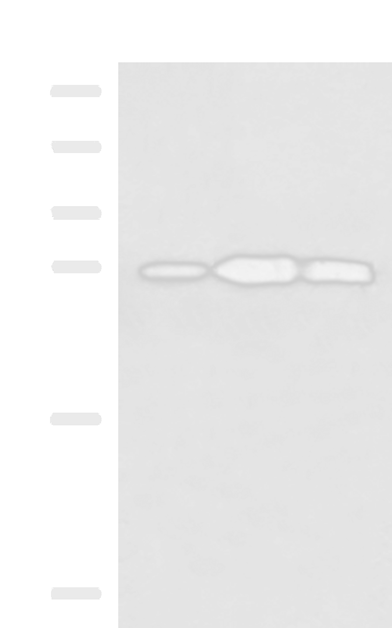 Western blot analysis of Mouse kidney tissue Raji and Jurkat cell lysates  using PLEKHF2 Polyclonal Antibody at dilution of 1:1400