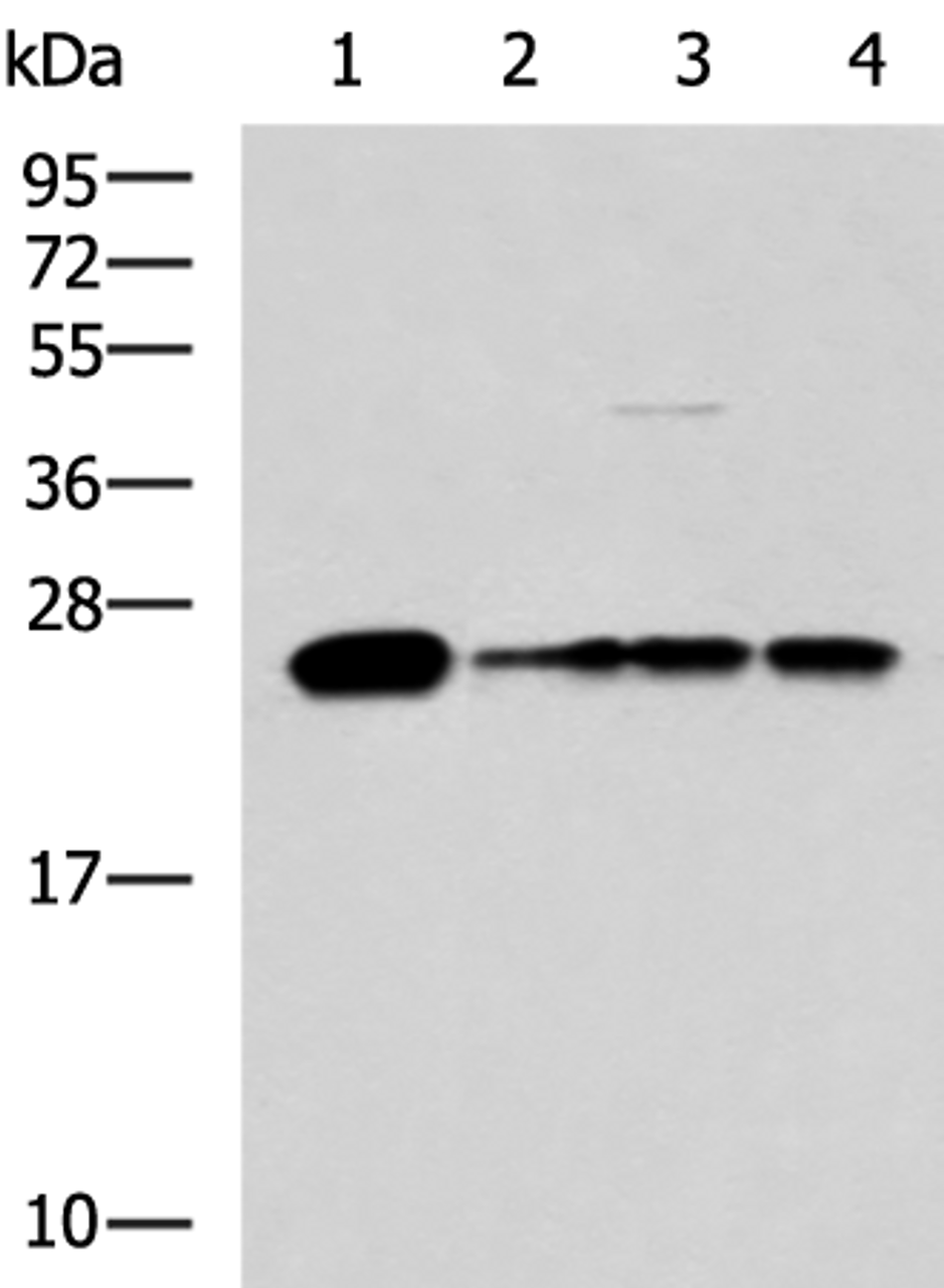Western blot analysis of 293T LO2 and HepG2 cell lysates  using MMAB Polyclonal Antibody at dilution of 1:1400