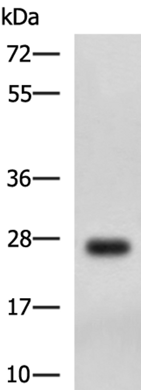 Western blot analysis of MCF7 cell lysate  using DHRS2 Polyclonal Antibody at dilution of 1:750