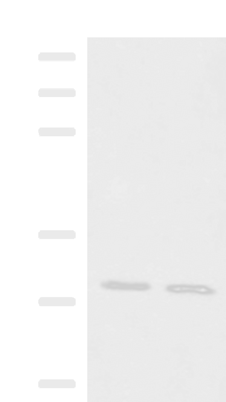 Western blot analysis of Mouse brain tissue Mouse kidney tissue lysates  using KRCC1 Polyclonal Antibody at dilution of 1:1350