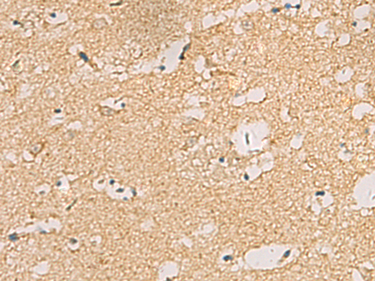 Immunohistochemistry of paraffin-embedded Human brain tissue  using CNST Polyclonal Antibody at dilution of 1:70(×200)