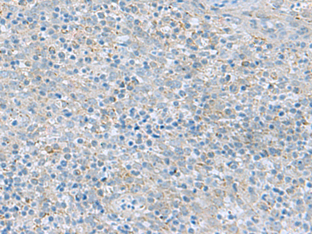 Immunohistochemistry of paraffin-embedded Human tonsil tissue  using PYCR2 Polyclonal Antibody at dilution of 1:40(×200)