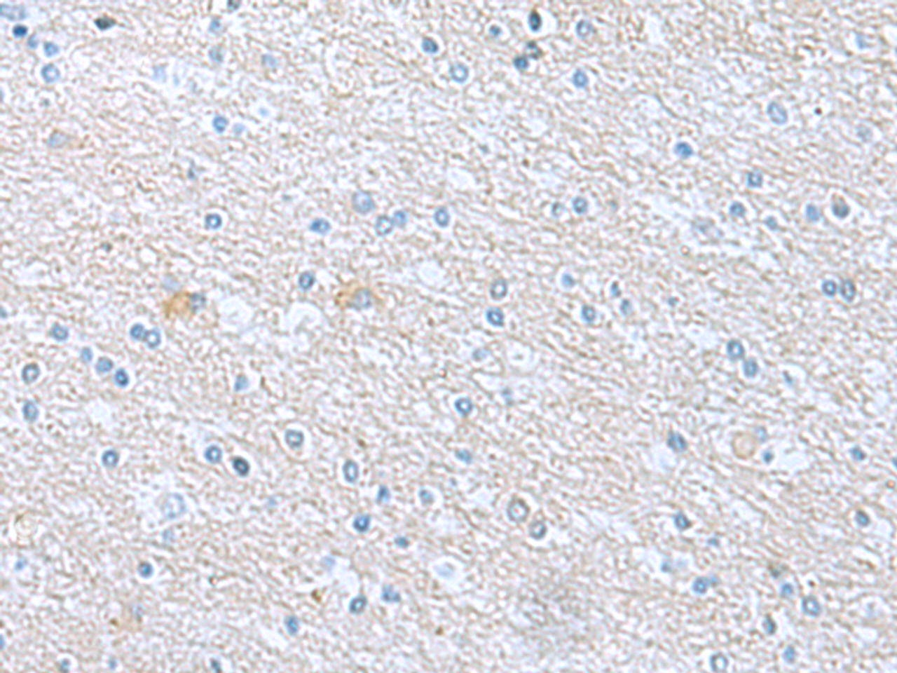Immunohistochemistry of paraffin-embedded Human brain tissue  using TSTA3 Polyclonal Antibody at dilution of 1:45(×200)