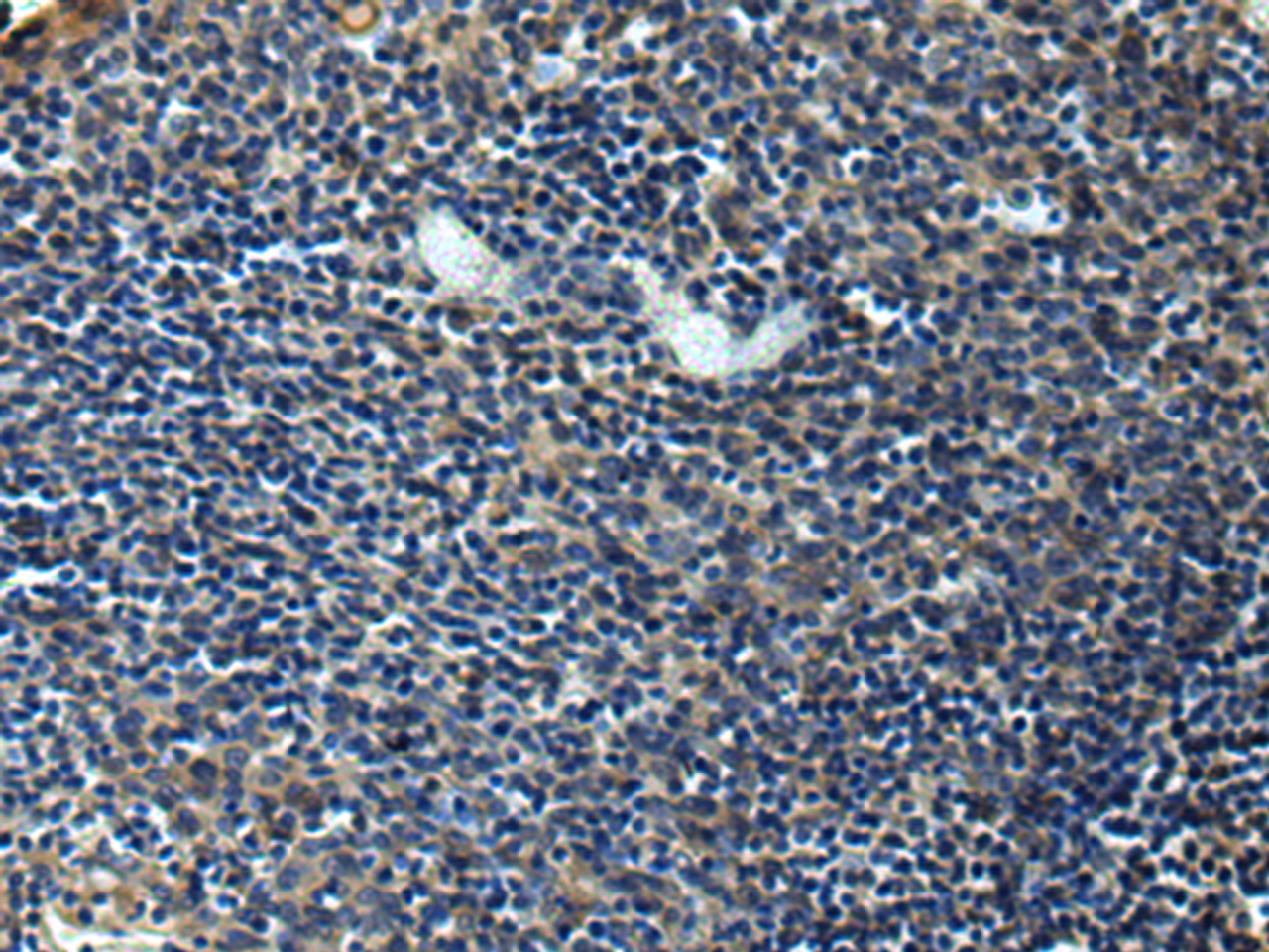 Immunohistochemistry of paraffin-embedded Human tonsil tissue  using ERLIN1 Polyclonal Antibody at dilution of 1:50(×200)