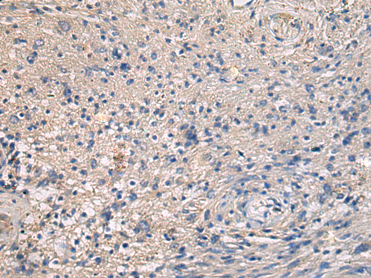 Immunohistochemistry of paraffin-embedded Human brain tissue  using MAPKAPK3 Polyclonal Antibody at dilution of 1:95(×200)