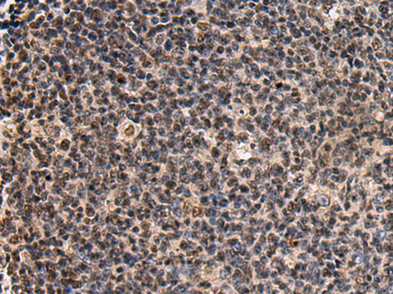 Immunohistochemistry of paraffin-embedded Human tonsil tissue  using SIK3 Polyclonal Antibody at dilution of 1:60(×200)