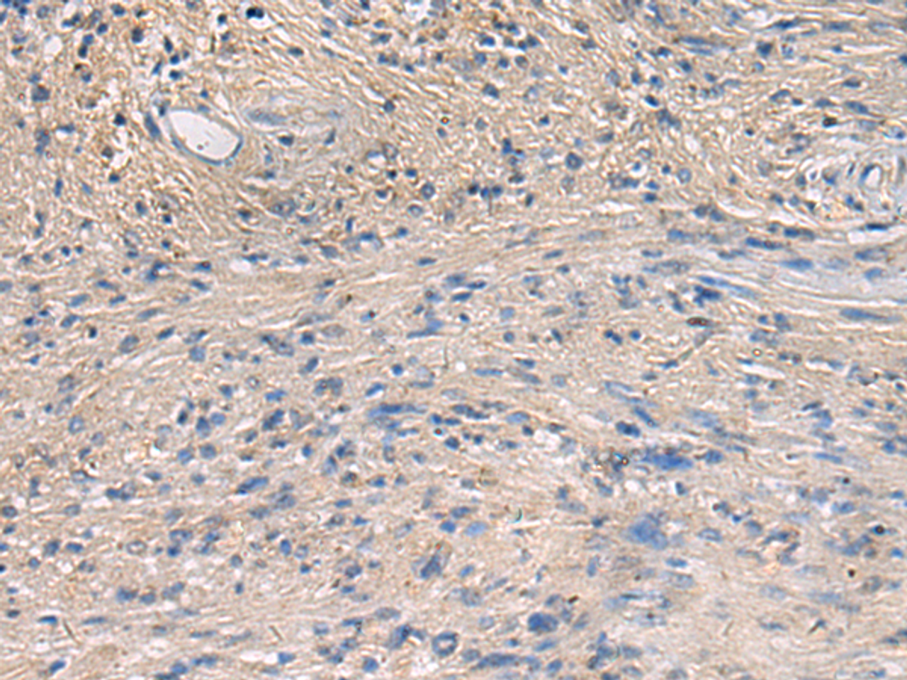 Immunohistochemistry of paraffin-embedded Human brain tissue  using PA2G4 Polyclonal Antibody at dilution of 1:60(×200)