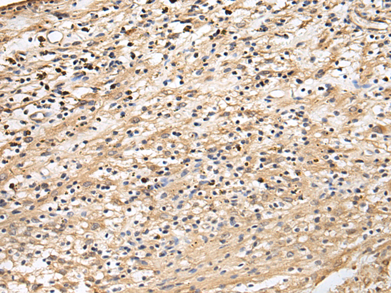 Immunohistochemistry of paraffin-embedded Human brain tissue  using CRACR2A Polyclonal Antibody at dilution of 1:60(×200)