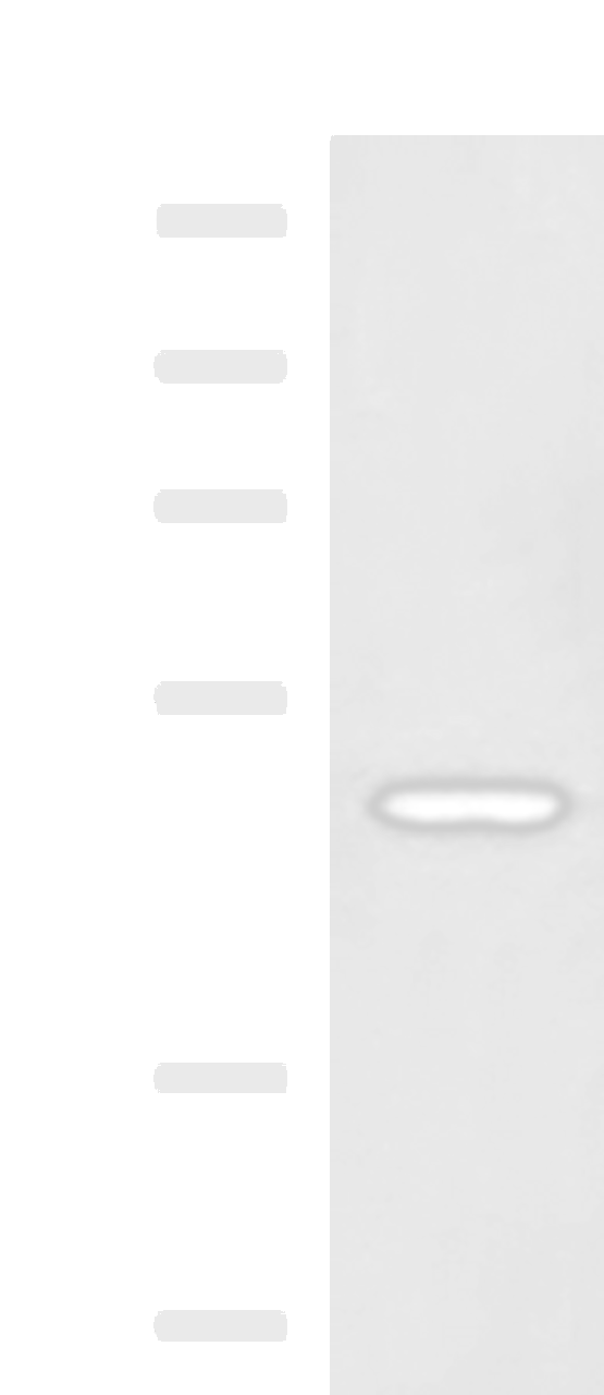 Western blot analysis of TM4 cell lysate  using SNIP1 Polyclonal Antibody at dilution of 1:1150