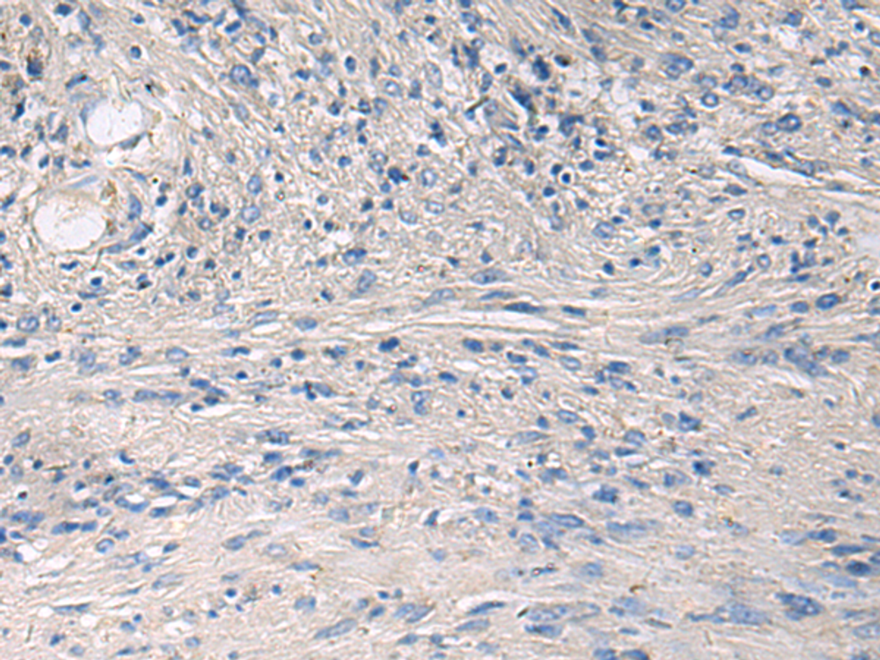 Immunohistochemistry of paraffin-embedded Human brain tissue  using PRKCSH Polyclonal Antibody at dilution of 1:65(×200)