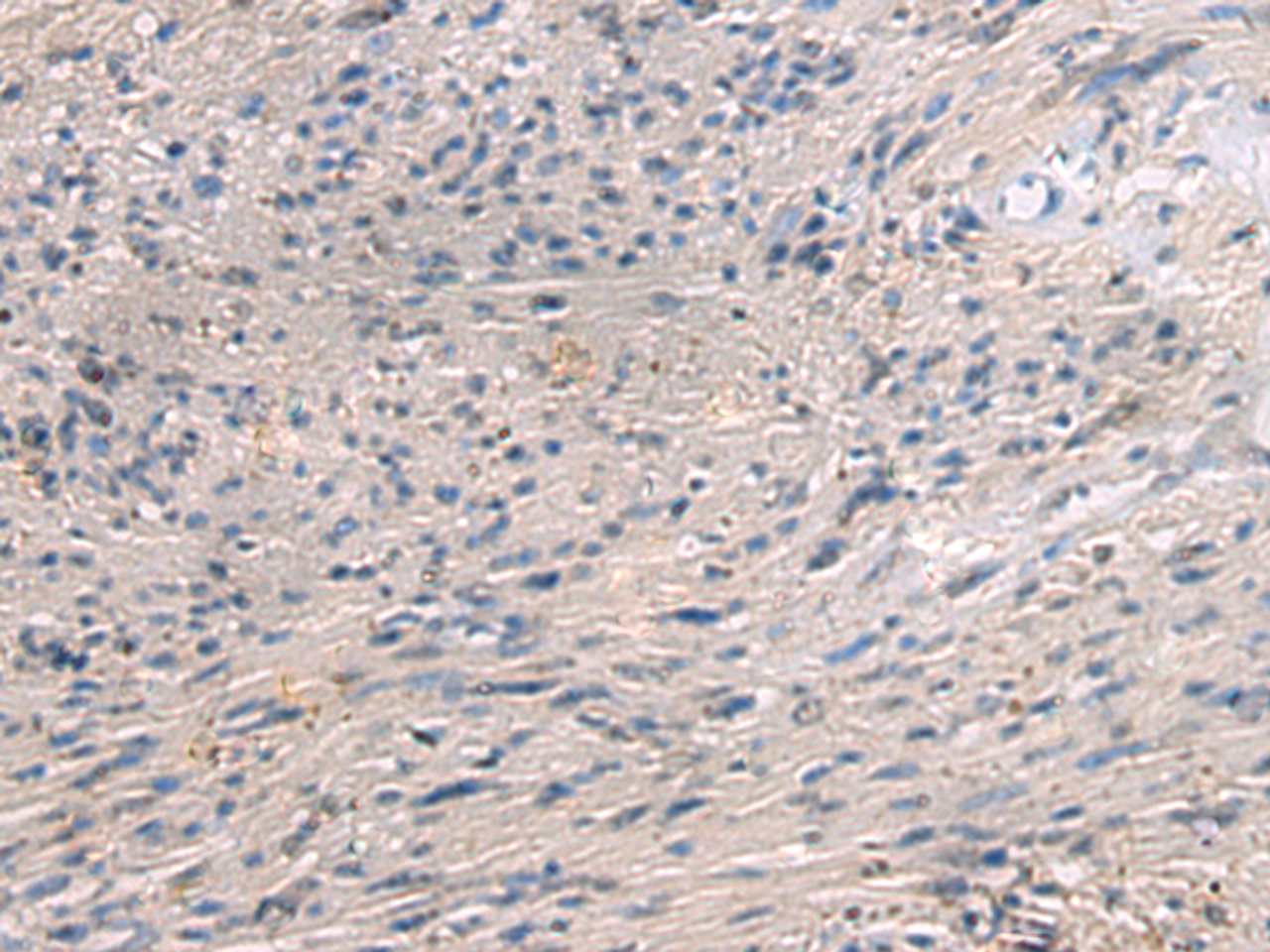 Immunohistochemistry of paraffin-embedded Human brain tissue  using PAIP1 Polyclonal Antibody at dilution of 1:80(×200)