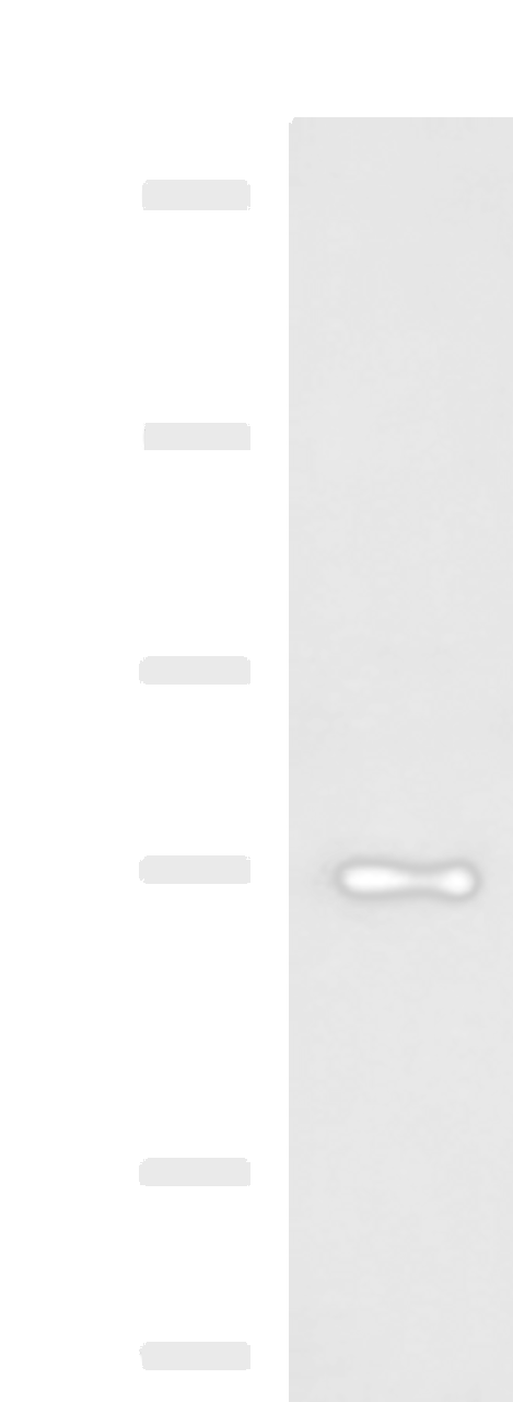 Western blot analysis of HepG2 cell lysate  using TTLL10 Polyclonal Antibody at dilution of 1:850