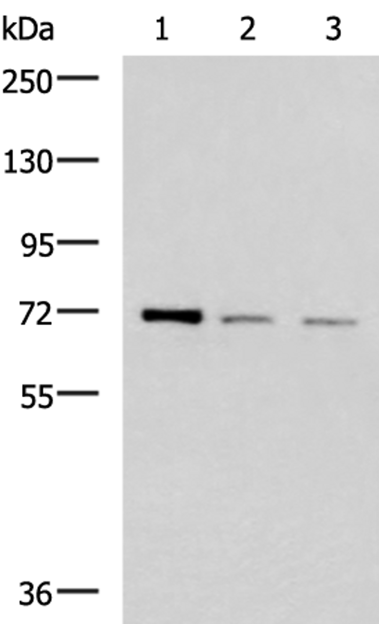 Western blot analysis of K562 HepG2 and Jurkat cell lysates  using FOXK1 Polyclonal Antibody at dilution of 1:400