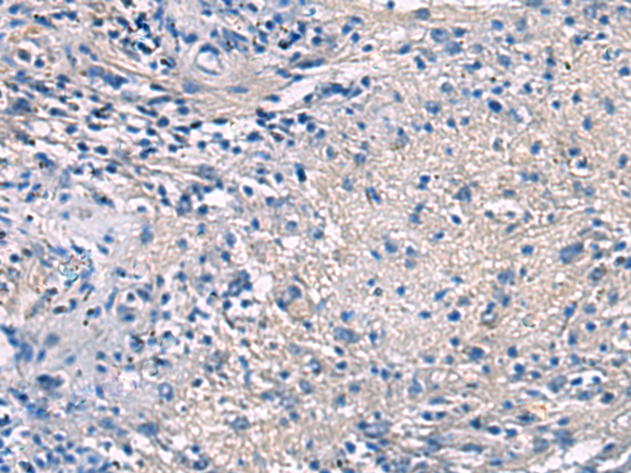 Immunohistochemistry of paraffin-embedded Human brain tissue  using PROKR2 Polyclonal Antibody at dilution of 1:40(×200)