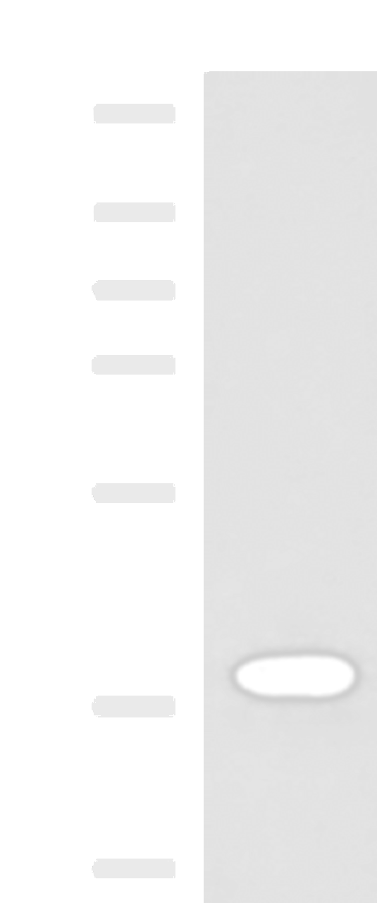 Western blot analysis of Human placenta tissue lysate  using GPR6  Polyclonal Antibody at dilution of 1:1000