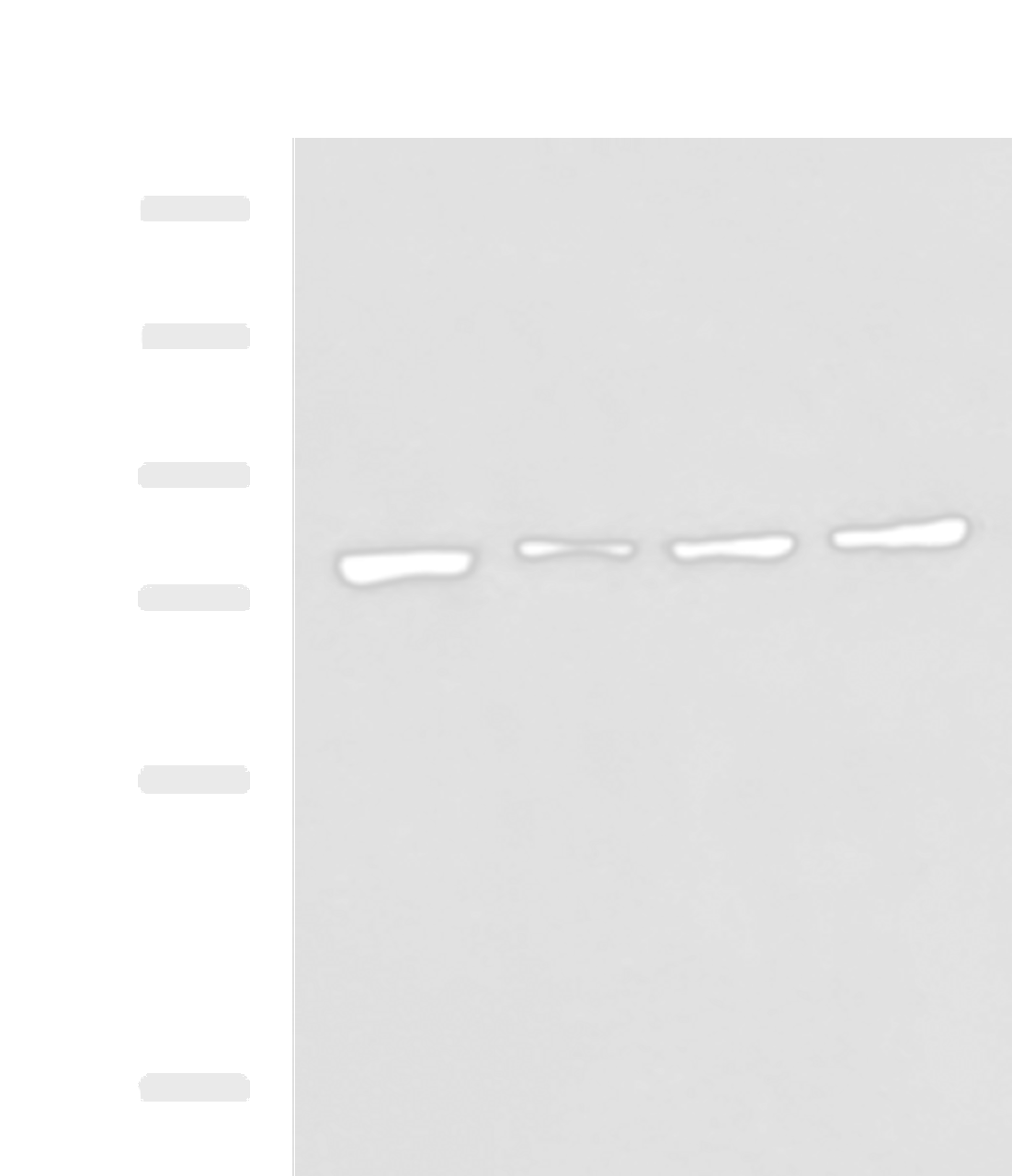 Western blot analysis of RAW264.7 MCF7 Jurkat and A431 cell lysates  using HSPA5 Polyclonal Antibody at dilution of 1:400