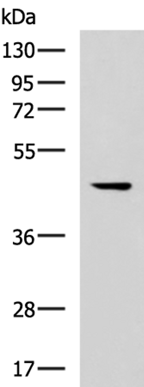Western blot analysis of 293T cell lysate  using MLNR Polyclonal Antibody at dilution of 1:500