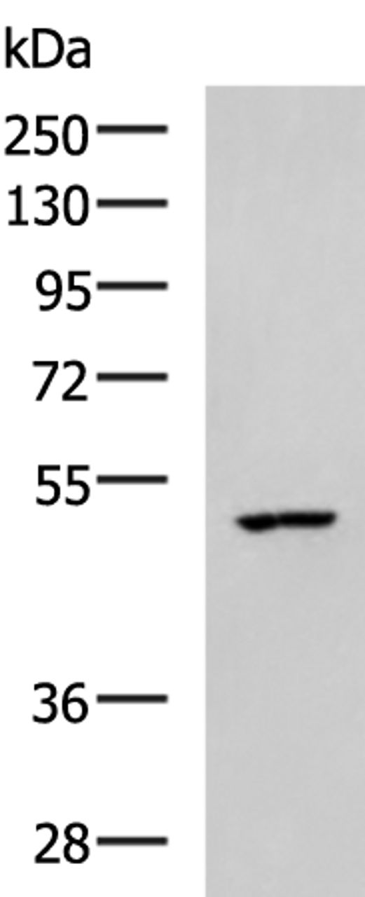 Western blot analysis of MCF7 cell lysate  using CKMT1A/CKMT1B Polyclonal Antibody at dilution of 1:600