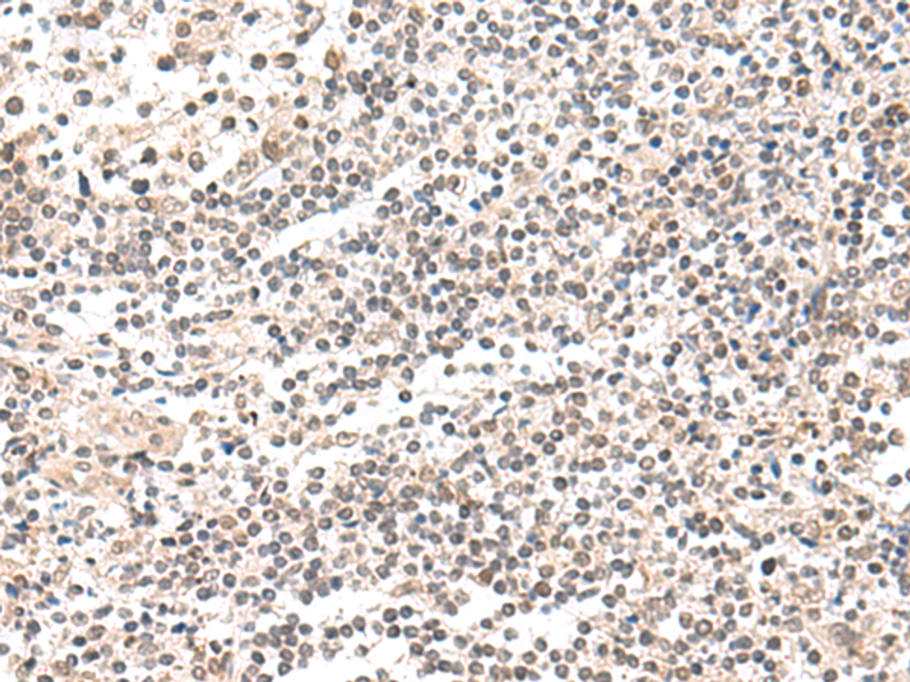 Immunohistochemistry of paraffin-embedded Human tonsil tissue  using CKMT1A/CKMT1B Polyclonal Antibody at dilution of 1:55(×200)