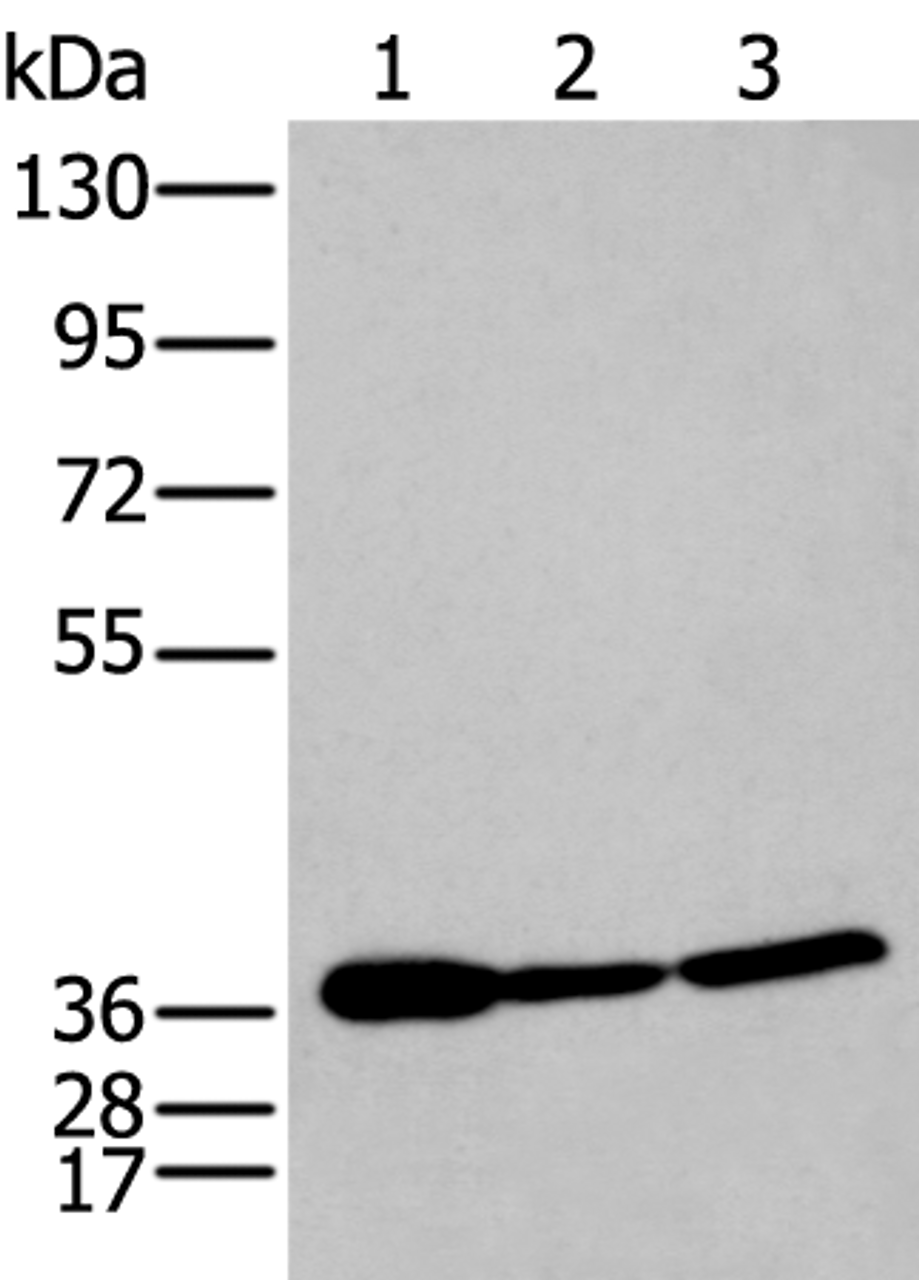 Western blot analysis of 293T and Hela cell lysates  using P2RY11 Polyclonal Antibody at dilution of 1:250