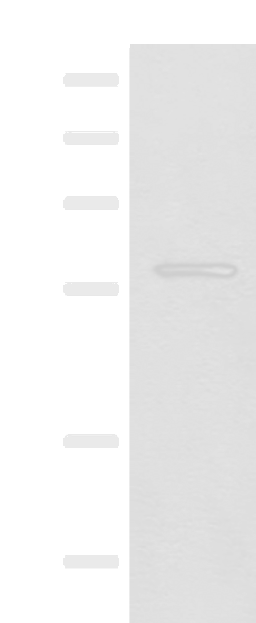 Western blot analysis of Mouse eye tissue lysate  using SLC5A1 Polyclonal Antibody at dilution of 1:500