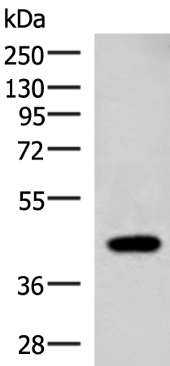 Western blot analysis of Raji cell lysate  using ADH1B Polyclonal Antibody at dilution of 1:1000