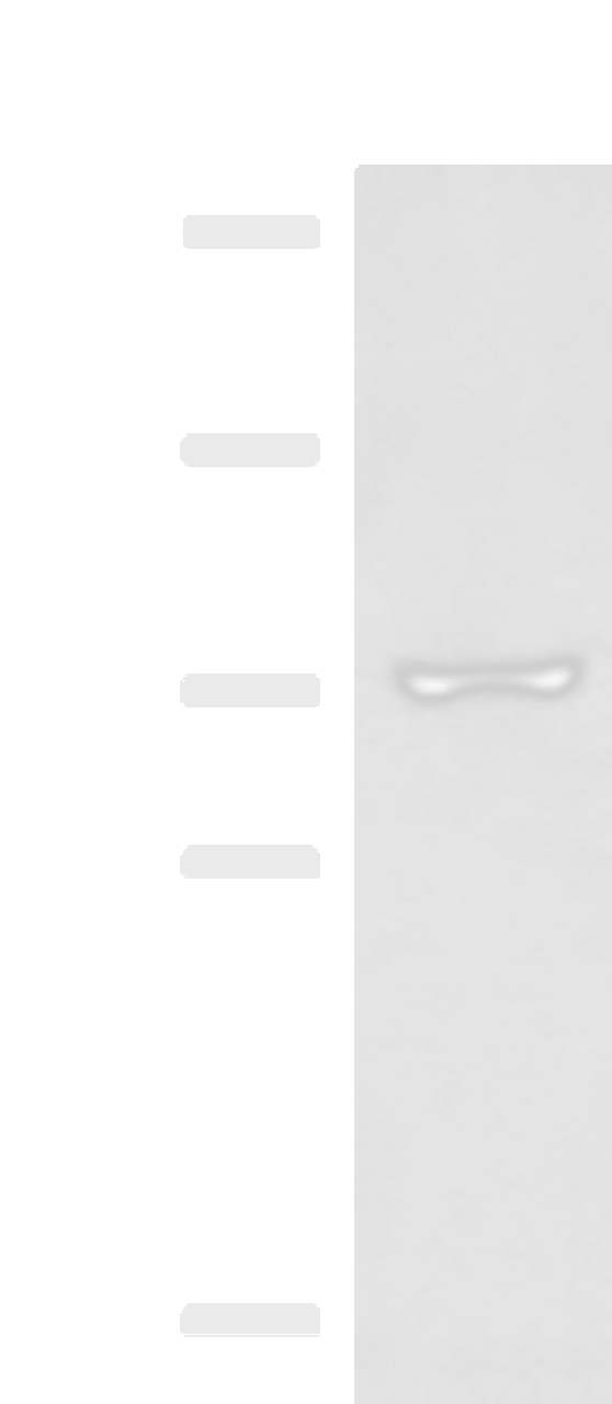 Western blot analysis of 293T cell lysate  using GLS Polyclonal Antibody at dilution of 1:850