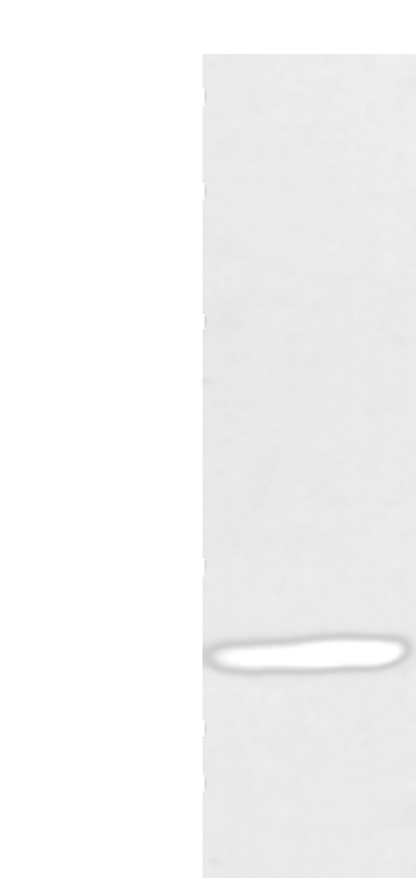 Western blot analysis of Human fetal brian tissue  using CALB2 Polyclonal Antibody at dilution of 1:400